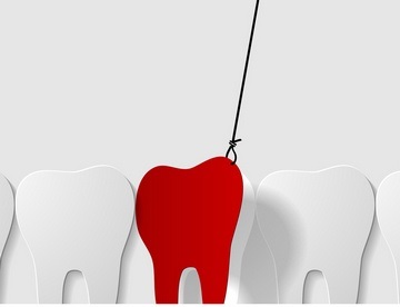 Răzbunarea de sânge a gingiilor este un fenomen normal de sânge după extracția dinților