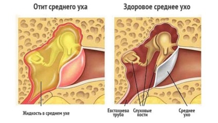 Лікування захворювань ЛОР-органів остеопатії - центр - остеопат