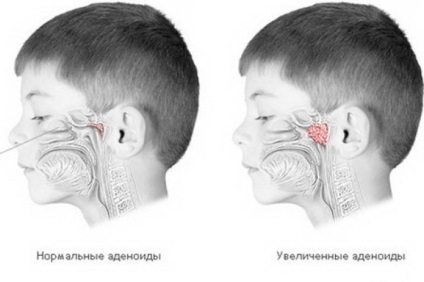 Лікування захворювань ЛОР-органів остеопатії - центр - остеопат