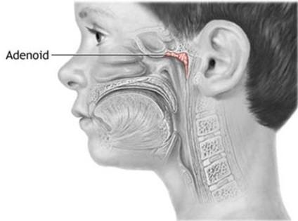 Tratamentul bolilor organelor ORL cu osteopatie - centru - osteopat