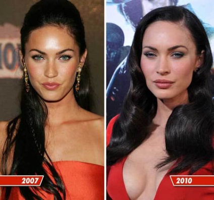 Megan fox - chirurgie plastica, fotografii înainte și după