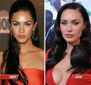 Rezultatele Megan Fox înainte și după operațiuni