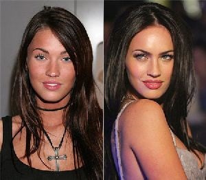 Rezultatele Megan Fox înainte și după operațiuni