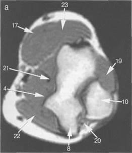 Anatomia mătcii articulației cotului