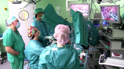 Chirurgie pentru eliminarea diverticulului, rezecția diverticulozei intestinului, indiferent dacă este necesară curățarea,