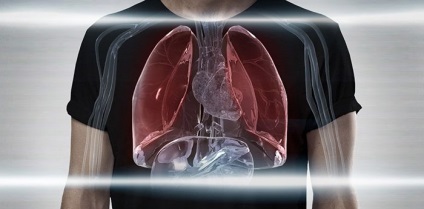 Carcinomul celulelor scuamoase din stadiul pulmonar și prognosticul