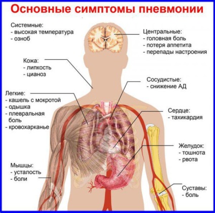 Simptome de pneumonie la adulți cu o temperatură de 37, 38, 39, pneumonie atipică, semne