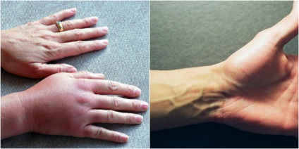 De ce mâinile proastă 7 motive bune pentru a verifica sănătatea lor - smilepub