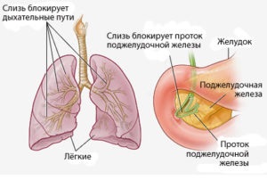 Pancreasul cum doare și unde este, simptomele