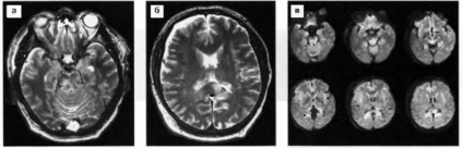Deteriorarea creierului - leziuni craniocerebrale la copii