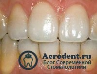 Cauzele bolilor dentare - stomatologie din Moscova