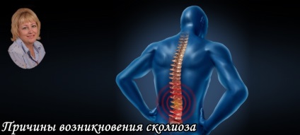 Okai scoliosis, Akadémia univerzum boldogság