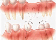 Proteză, Ukrdental primul server dentar ucrainean