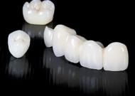 Proteză, Ukrdental primul server dentar ucrainean