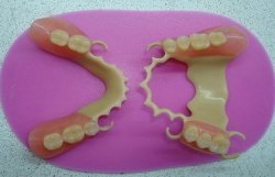 Protetica dentară - stomatologie