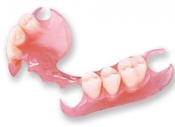 Протезування зубів - Стоматологія солнцево парк