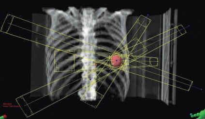 Radiurgia la clinica emc din Moscova