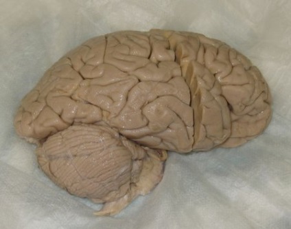 A legkisebb agy a világon - anatómia