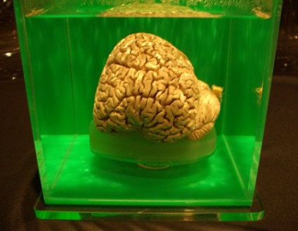 Cel mai mic creier din lume este anatomia