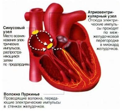 Синдром слабкості синусового вузла причини, лікування, профілактика