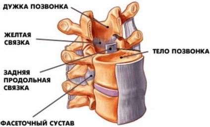 Спондилоартроз що це таке, лікування при болях деформуючого спондилоартрозу суглобів