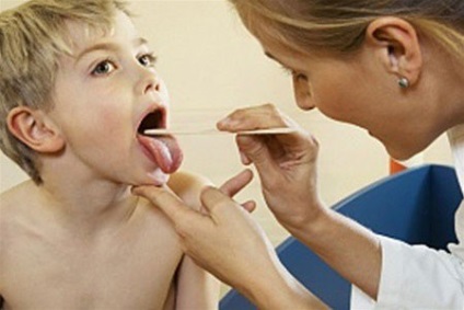 Streptococul în gât este un pericol care trebuie eliminat
