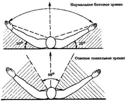 Viziune tunel, semne, simptome, diagnostic și tratament