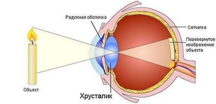 Вправи для поліпшення зору при короткозорості в домашніх умовах