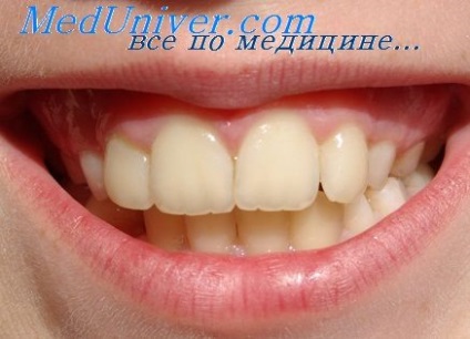 Усунення порушень мови в стоматології