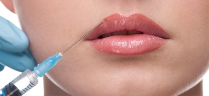 Збільшення губ препарати, процедура, ефект і протипоказання, портал