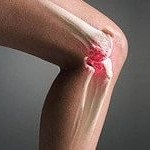Valgus deformare a piciorului - motivele pentru apariția oaselor pe picioare și tratamentul acesteia, medicina populară