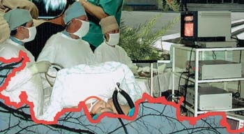 Corecția chirurgicală și endovasculară a tulburărilor ritmului cardiac 2008 355026 opol, nativ,