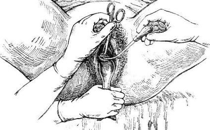 Proba uterului, ginecologie