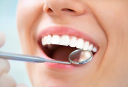 10 Актуальних питань про імплантацію зубів