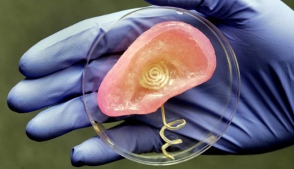 5 Фактів про трансплантацію органів