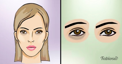 5 Способів позбутися від мішків під очима