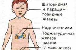 АФО ендокринної системи у дітей раннього (дошкільного) віку (фото і відео)