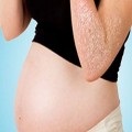 Алергія під час вагітності лікування і наслідки
