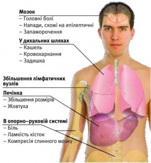 Анатолій щербина робить ліки з 29 рослин, новини на