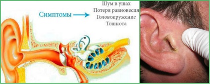 Boli ale urechilor la om, este interesant de știut