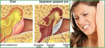 Boli ale urechilor la om, este interesant de știut