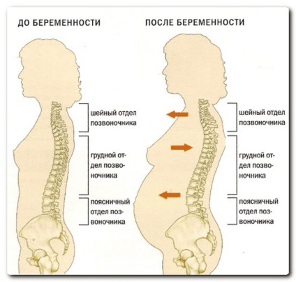 Dureri de spate în implantarea embrionilor