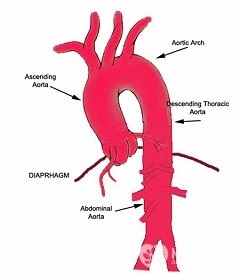 Arcul aortic - ramuri, structură, boli