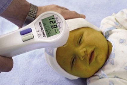 Icterul fiziologic al nou-născuților