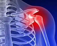 Гімнастика при артрозі плечового суглоба ЛФК, зарядка і комлекс вправ в лікуванні артрозу плеча