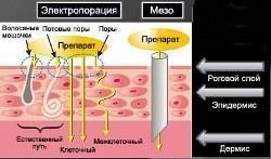 Іонна мезотерапія особи що це таке, показання, протипоказання