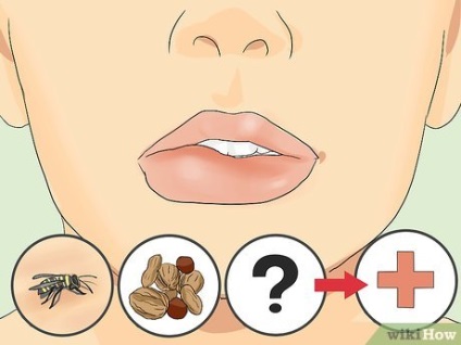 Hogyan kezeljük az ajkak