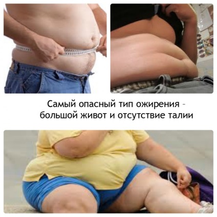 Як ожиріння впливає на серце, як правильно худнути, йога для схуднення, відео