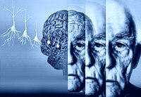 Cum să recunoaștem simptomele de demență senilă