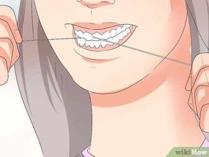 Як доглядати за стоматологічним ретейнер